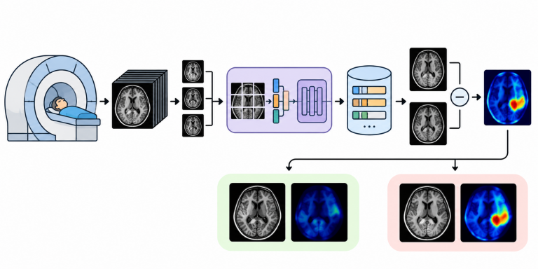 Transformer-Based Anomaly Detection for Neurodegenerative Screening in MRI Images. (2026)